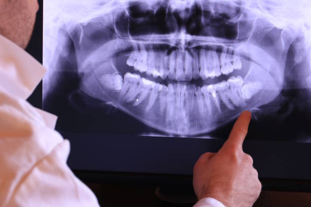 Best Emergency Dental Care for Broken or Chipped Teeth in Blanding, UT