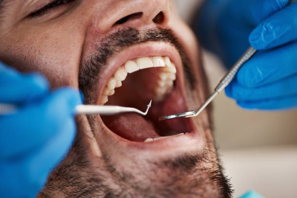 Best Emergency TMJ Treatment in Blanding, UT