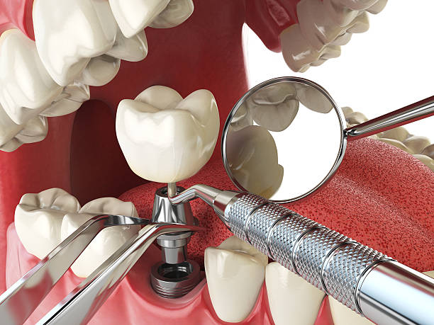 Best Emergency Gum Treatment in Blanding, UT